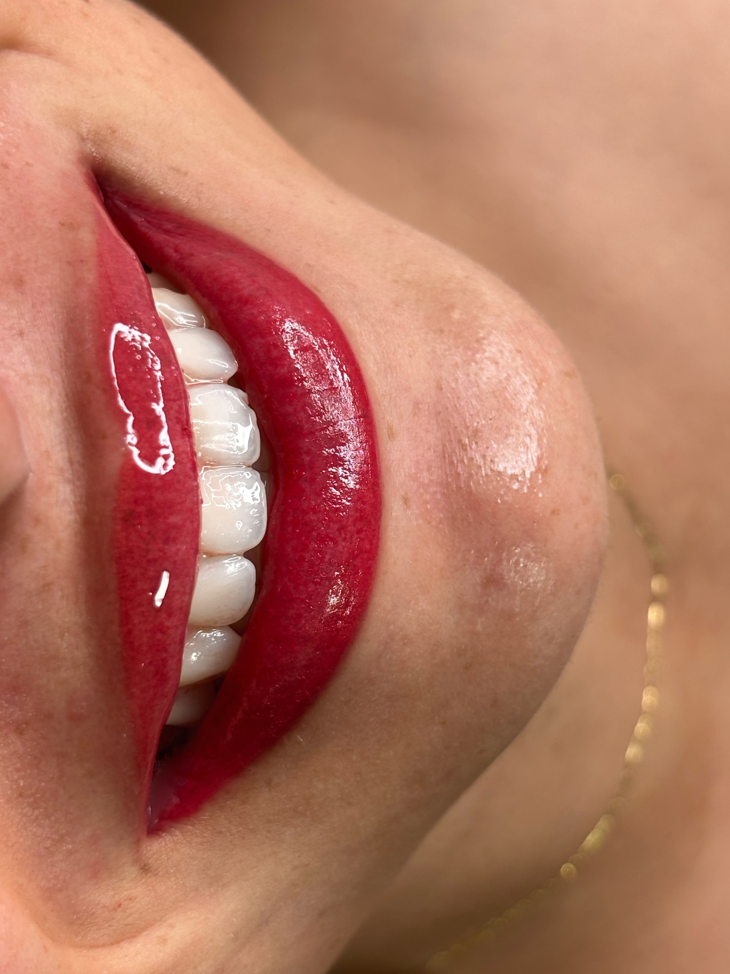 Resultado micropigmentação labial